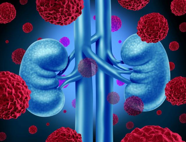 Zbog čega su neki karcinomi zloćudniji od drugih?